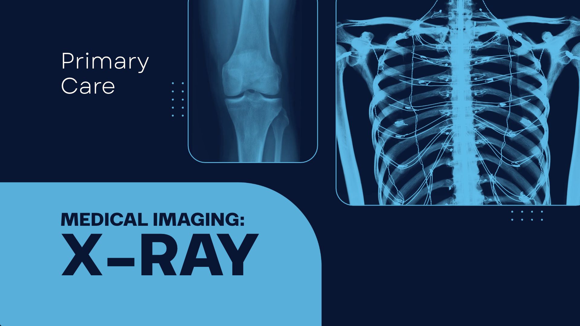 What Primary Care With On-Site X-Ray Can Do for You